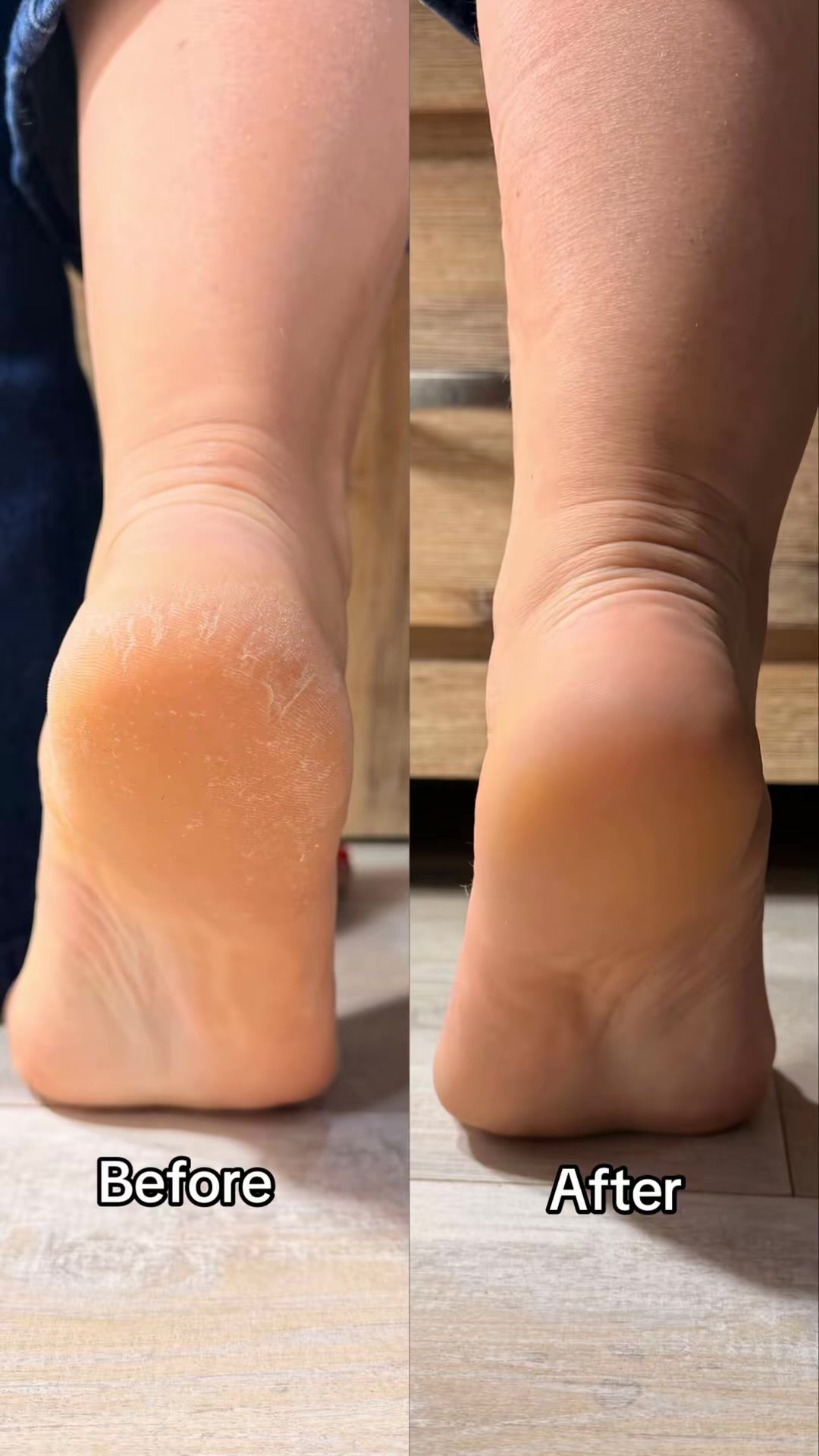 GlowEra Silky Sole™ Cordless Foot Exfoliator + 6 Grinding Heads