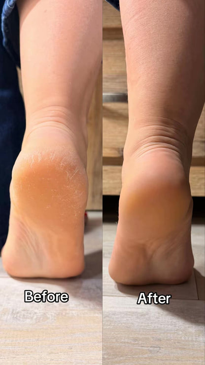GlowEra Silky Sole™ Cordless Foot Exfoliator